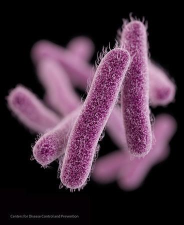 美国现首例-超级细菌- 全球无任何抗生素可治(图)