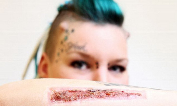 英国女子受情伤割掉纹身自断手指 称“我愿意”