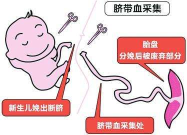 北京3岁男童移植自体脐带血救命