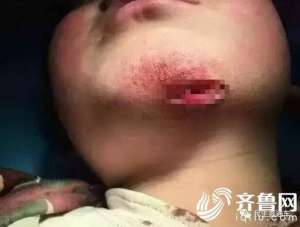 女子虐打男童被拘 网友愤怒：对一个孩子如此残忍要严惩这种行为