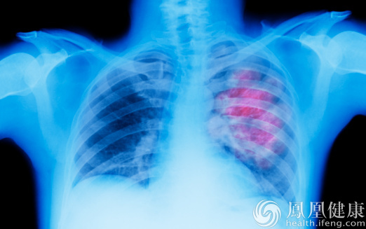 北京市发布2015年健康白皮书 恶性肿瘤最致命肺癌排第一