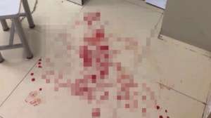 上海一急诊医生被患者殴打缝7针 满地血迹(图)