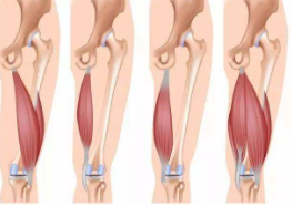 大腿肌肉拉伤原因
