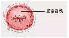 妇科千金片治疗宫颈炎吗