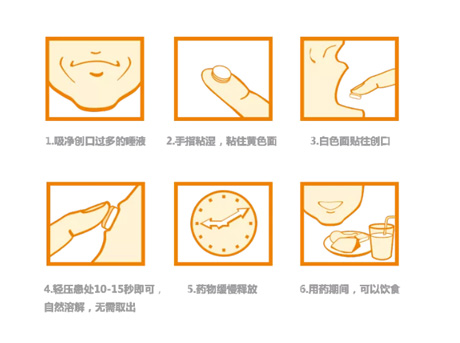 治疗口腔溃疡快的药是哪个?一撕一贴，搞定！