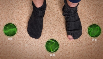 灰指甲脚气的治疗，这样的方法，才能收到更好的效果
