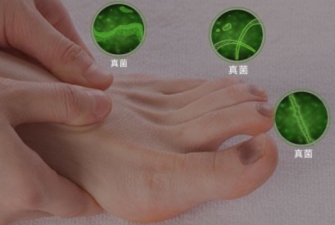 灰指甲脚癣的治疗，效果比较不错的，还得说是它