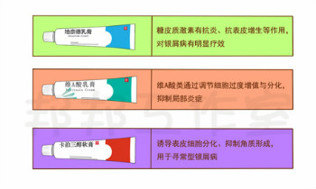 怎样治疗银屑病？这些方法快来了解