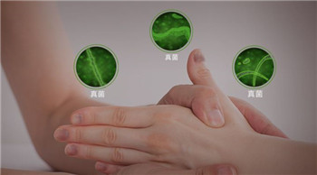 怎样治疗顽固性灰指甲？用对方法是关键