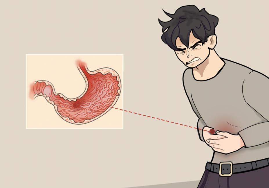 胃溃疡能治好吗？做好这些，病痛自然会远离