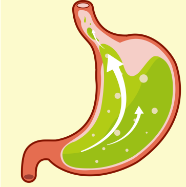 胃酸过多能吃金奥康奥美拉唑吗？怎样调理可以缓解呢？