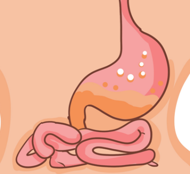 胃溃疡疾病危害大！患上胃溃疡要怎么治疗效果比较好？