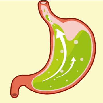 胃酸反流吃什么中成药有效？抑制胃酸分泌也很重要