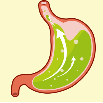 胃酸反流是怎么引起的？医生提醒这几点要注意