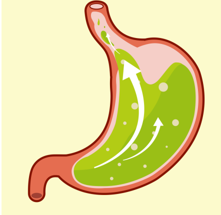 胃酸过多怎么调理最快最有效？用它迅速缓解胃部不适