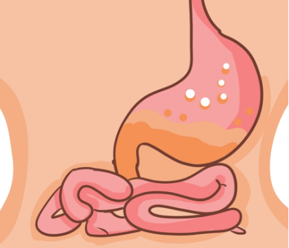 蒙脱石散可以用于胃溃疡吗？有治疗效果吗？