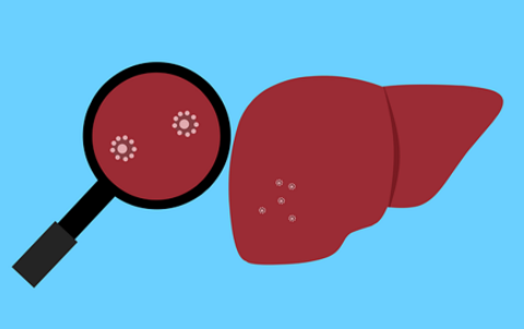 克癀胶囊有什么功效？治疗慢性病毒性肝炎效果如何？